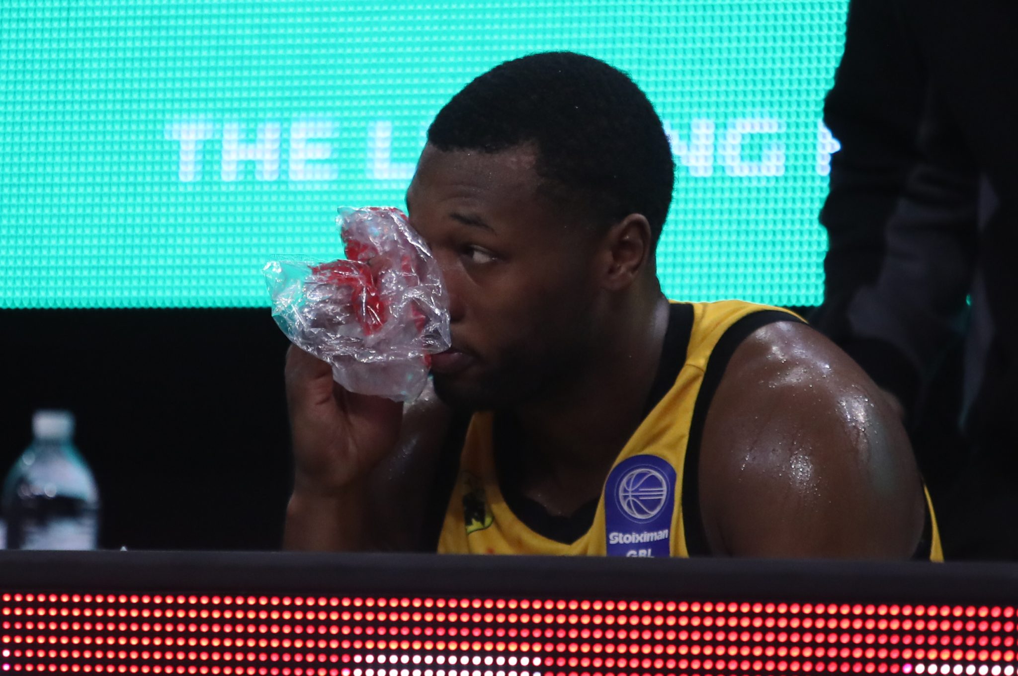 ΑΕΚ: Κάκωση στο μάτι ο Γκρέι